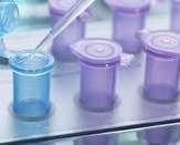 无精症患者通过特殊试管婴儿的完整流程解析